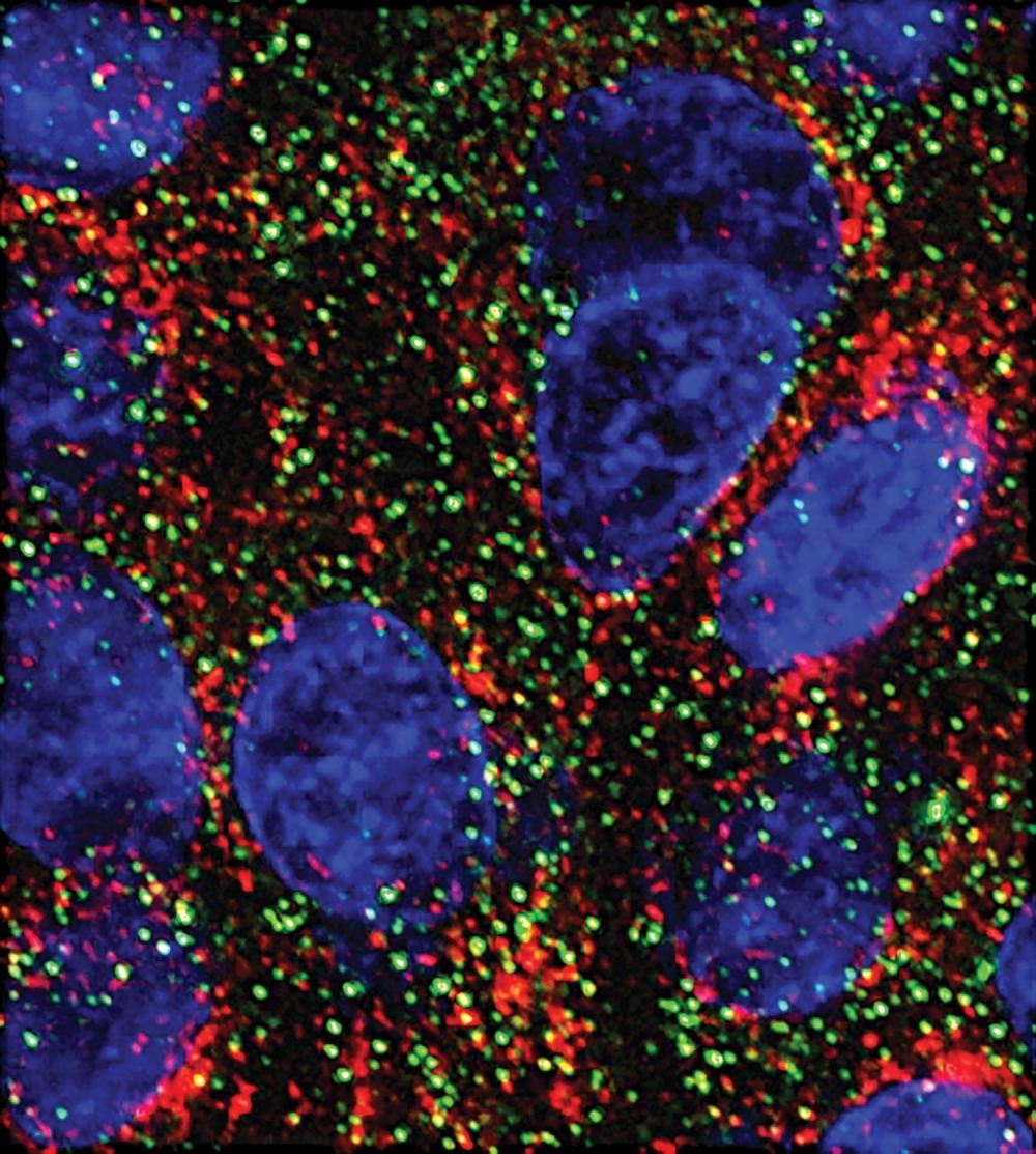 Dos microARN frenan el crecimiento de células pancreáticas en el laboratorio